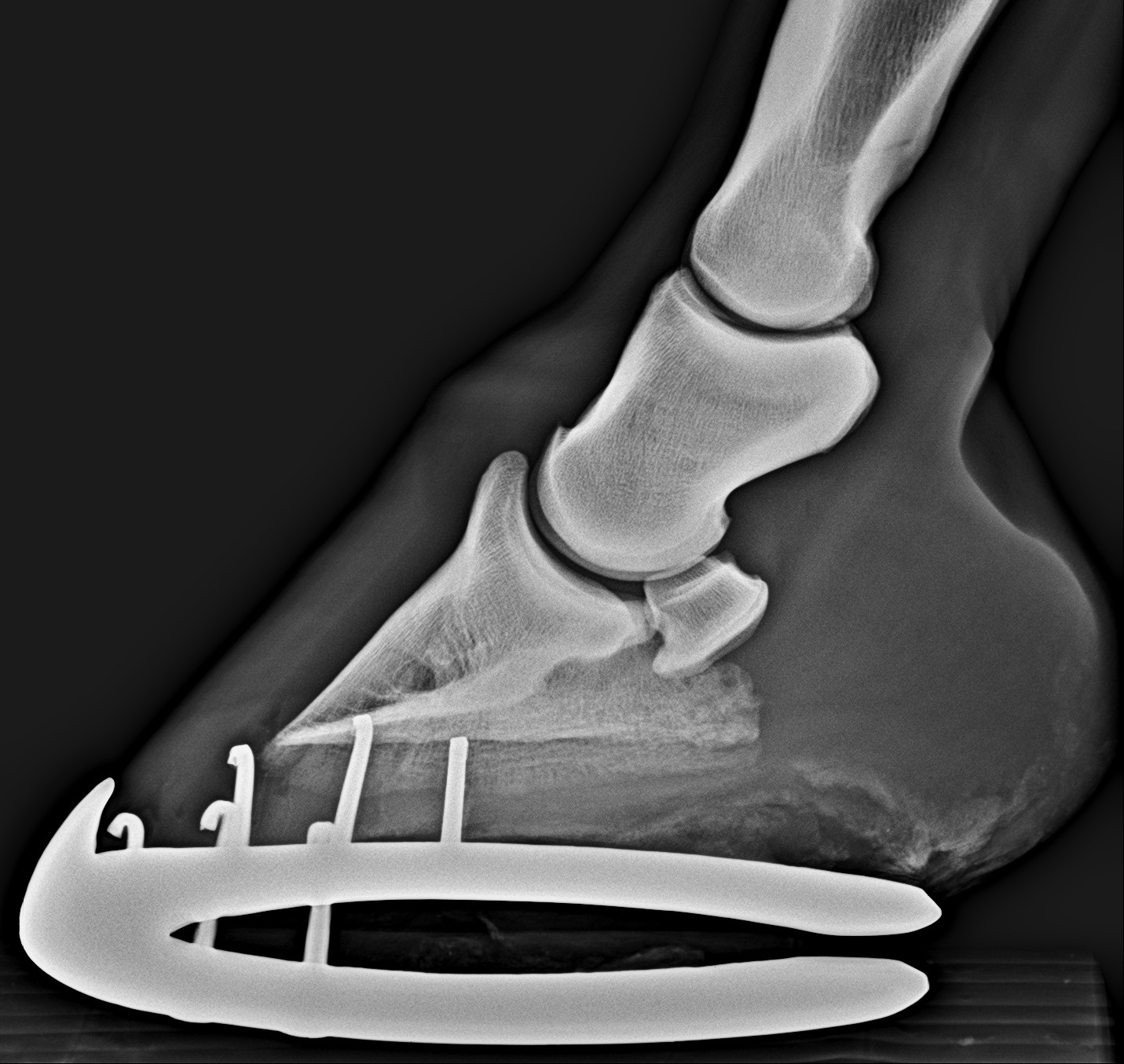 foot lm norm1
