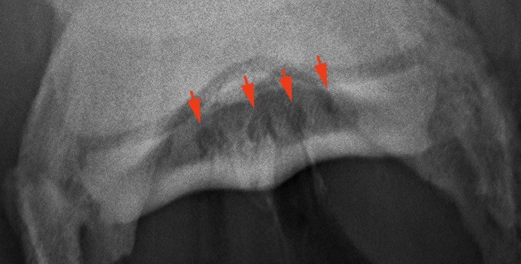 sky cyst3